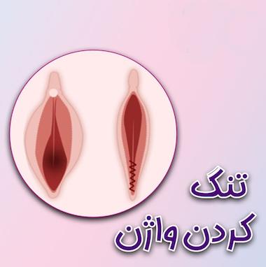 تنگ کردن واژن با روش‌های گیاهی و طبیعی