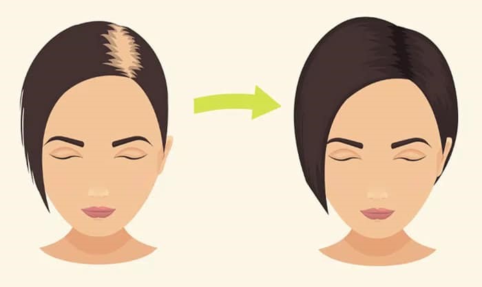 روغن سیرسیاه یا گیاسیر