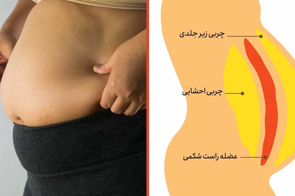 کپسول آنتی‌بلغم؛ همراه همیشگی سلامتی و تناسب اندام